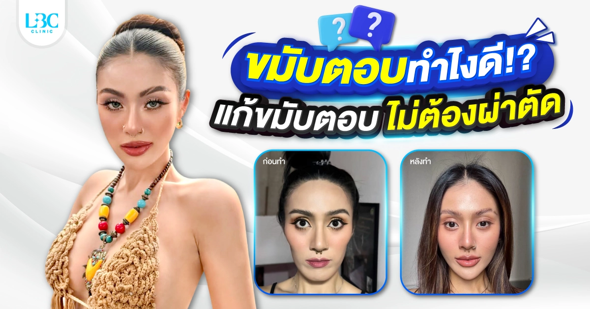 ขมับตอบทำไงดี? แก้ยังไงให้ดูละมุนอย่างเป็นธรรมชาติ?