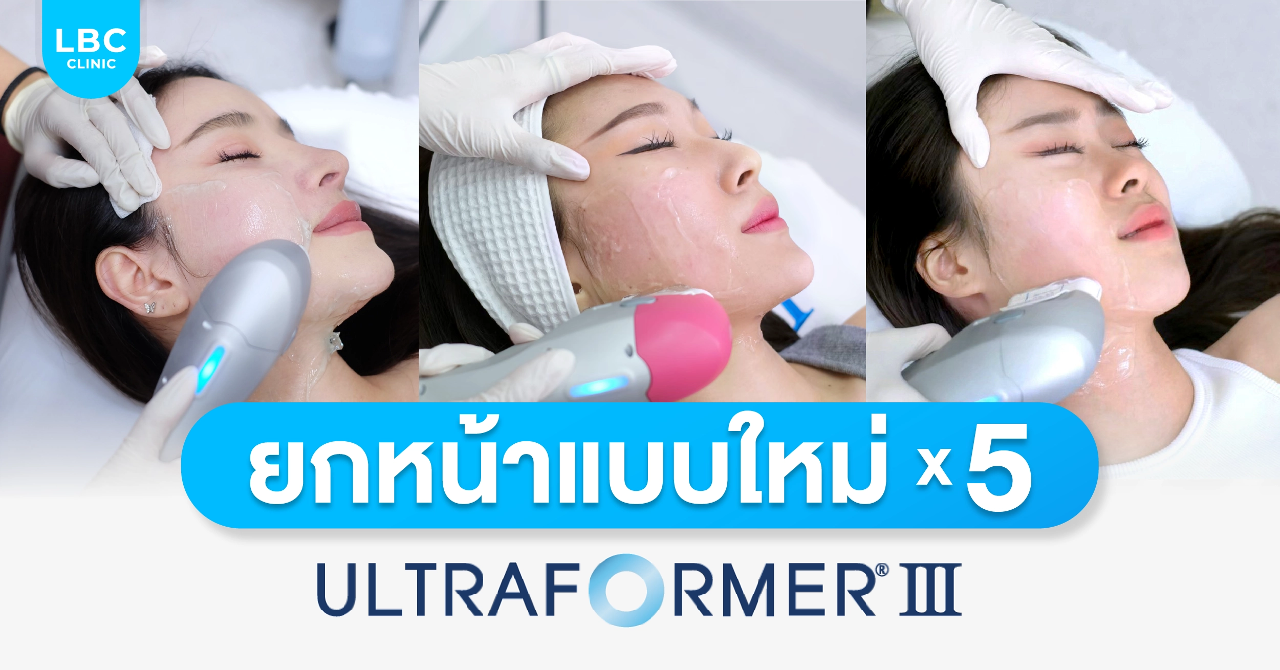 ยกหน้าให้กระชับแบบ X5 ด้วยเครื่อง Hifu Ultraformer lll