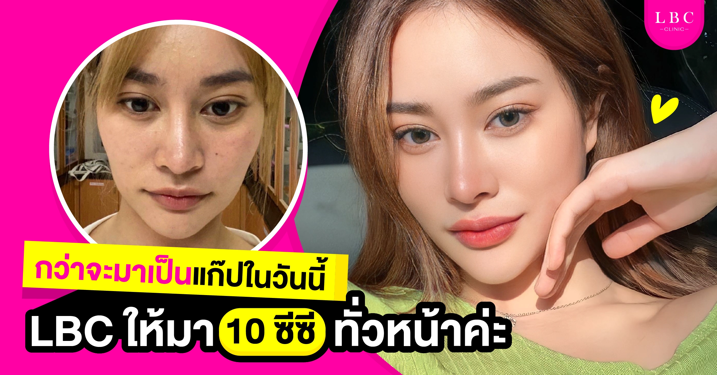 กว่าจะมาเป็นแก๊ปในวันนี้ LBC ให้มา 10 ซีซีค่ะ