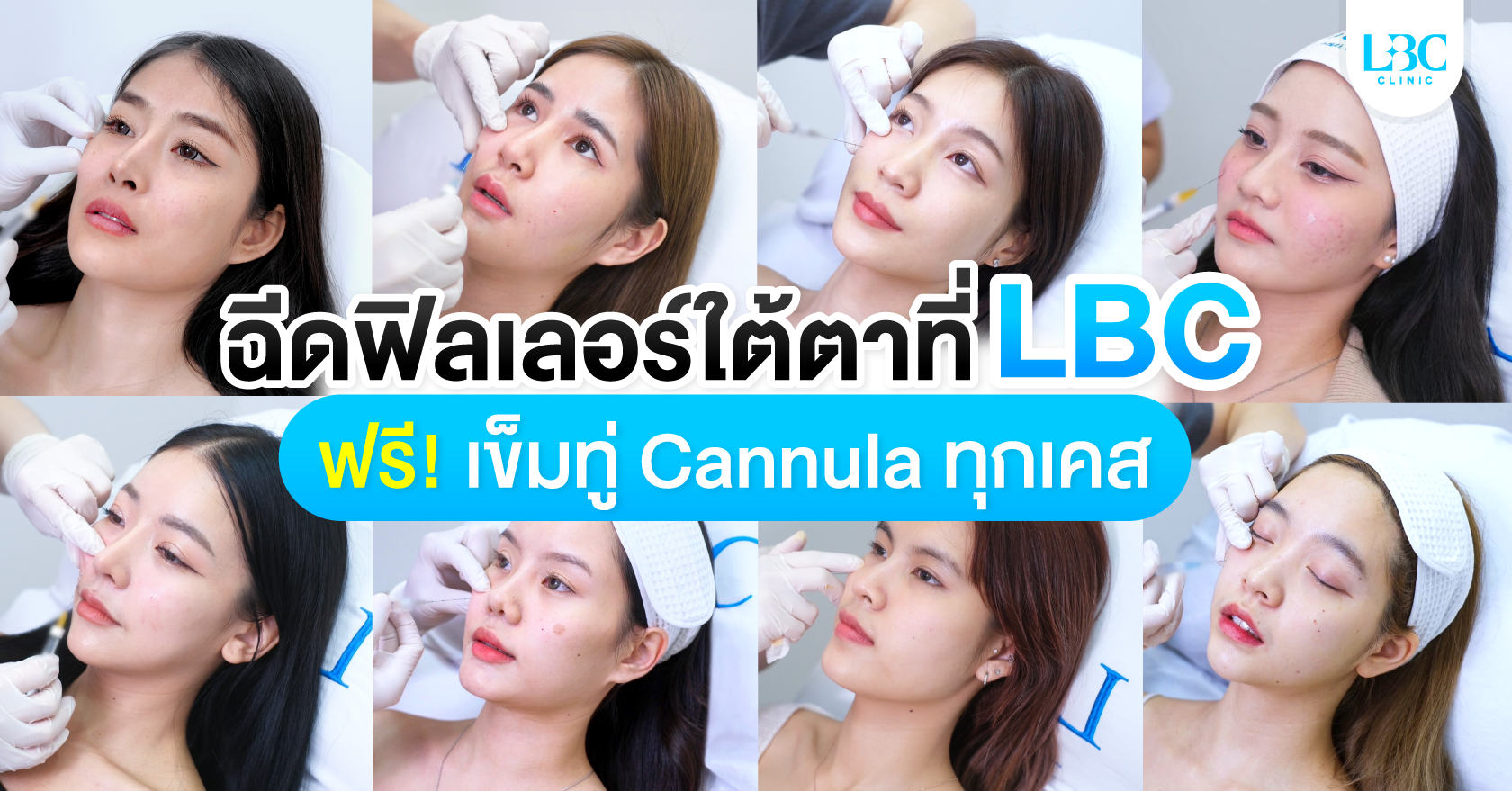 ฉีดฟิลเลอร์ใต้ตาที่ LBC ดียังไง!?