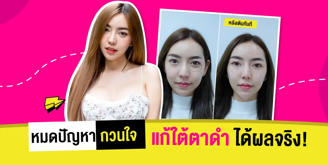 ฉีดฟิลเลอร์ใต้ตาลดใต้ตาคล้ำ มั่นใจได้เต็มที่