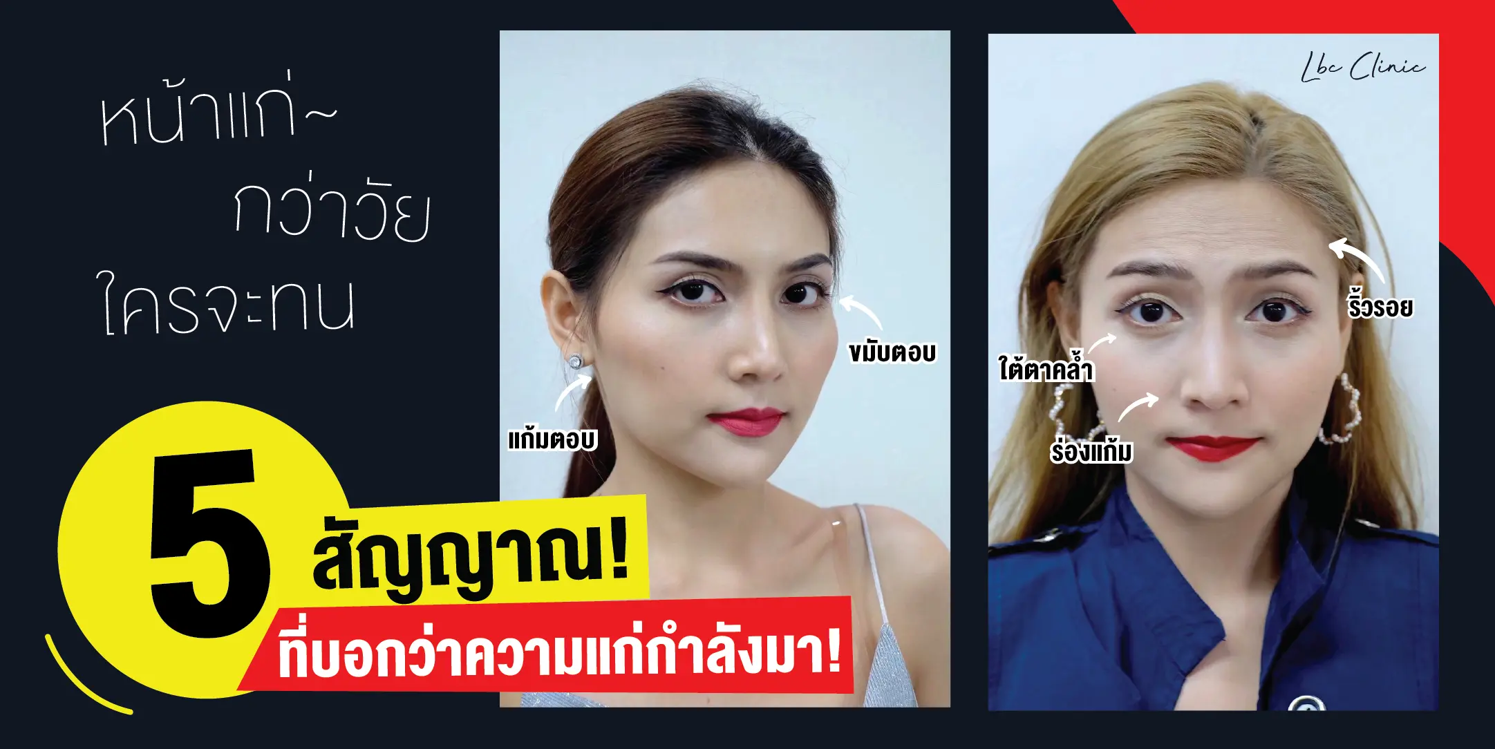 แก่ก่อนวัย! บอกลา 5 สัญญาณความแก่ด้วยฟิลเลอร์