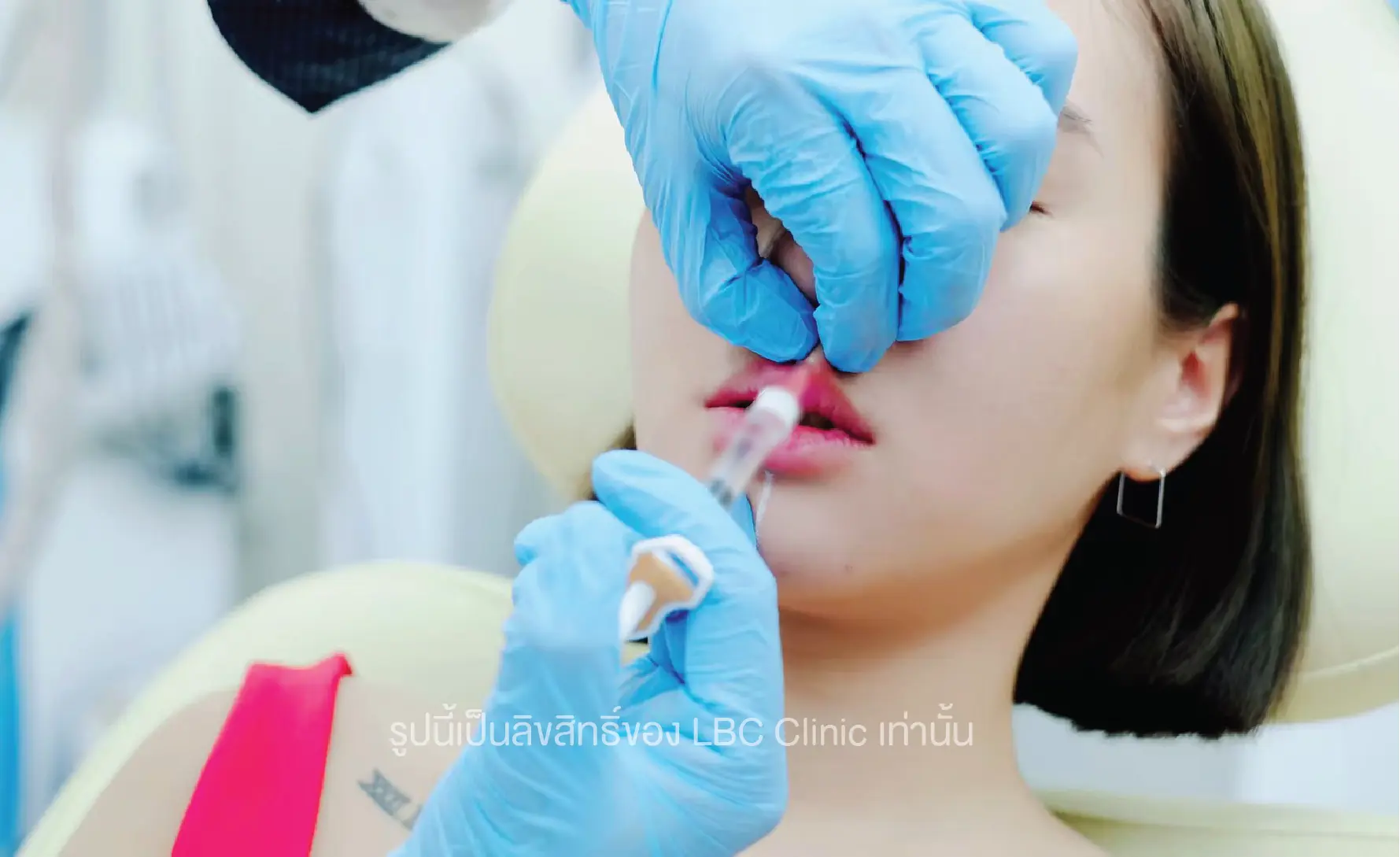 Lbc Clinic ฟิลเลอร์ปาก 