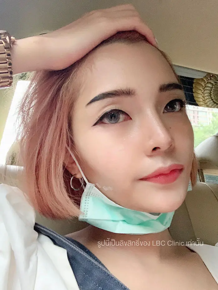 Lbc Clinic หลังทำ