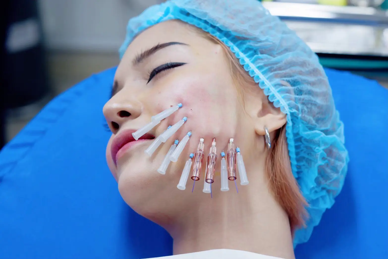 Lbc Clinic ร้อยไหม